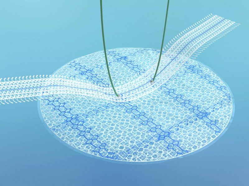 Umbilical/Epigastric Hernia Meshes